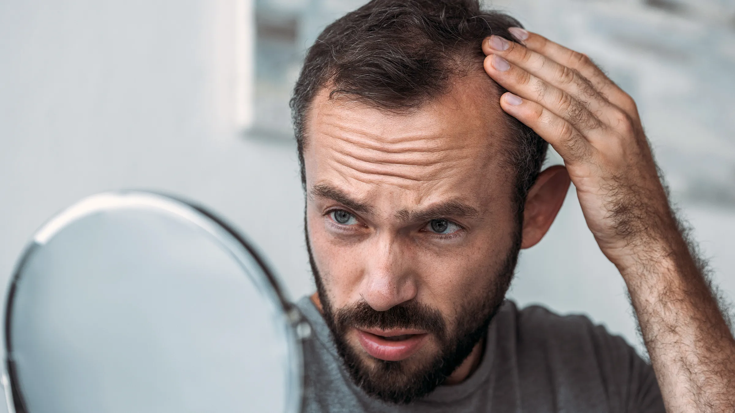Hair Transplant – Expert Care, Lasting Results