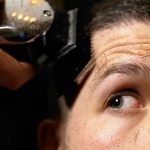 Hair Transplant Turkey: Cost, Techniques, and Clinic Reviews