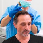 Hair Transplant Istanbul: Achieve Hair Perfection Safely